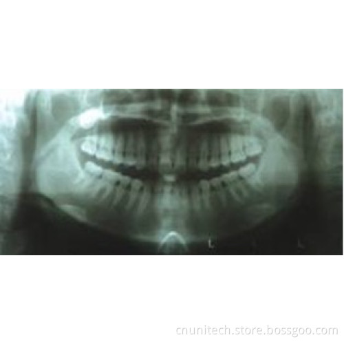 Digital Panoramic Dental X-ray Machine